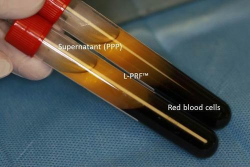 Magic PRF Box Magic PRF Box