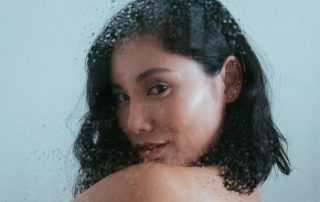 A woman looking fresh after polynucleotides + microneedling