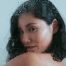 A woman looking fresh after polynucleotides + microneedling