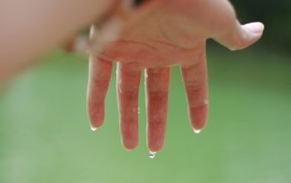 A wet hand due to hyperhidrosis