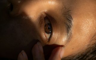 A woman's eye without makeup due to hyperhidrosis